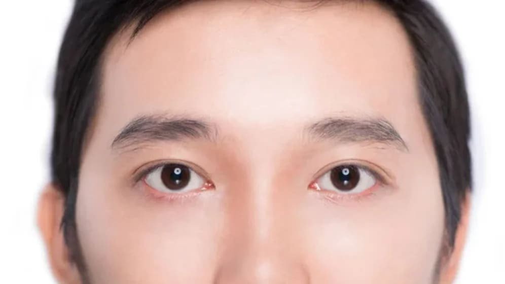 人臉的特寫鏡頭，聚焦在眼睛上，虹膜為棕色，內角周圍有輕微的紅色，背景模糊。